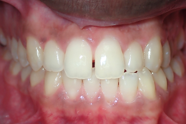 greenwich orthodontist near me before orthodontic treatment