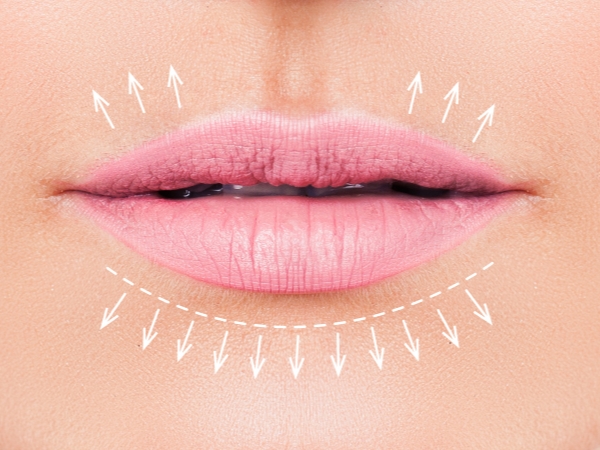 lip fillers near me greenwich